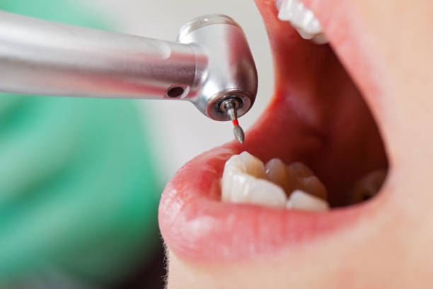 Best Emergency Gum Pain Relief  in Wilton, CA
